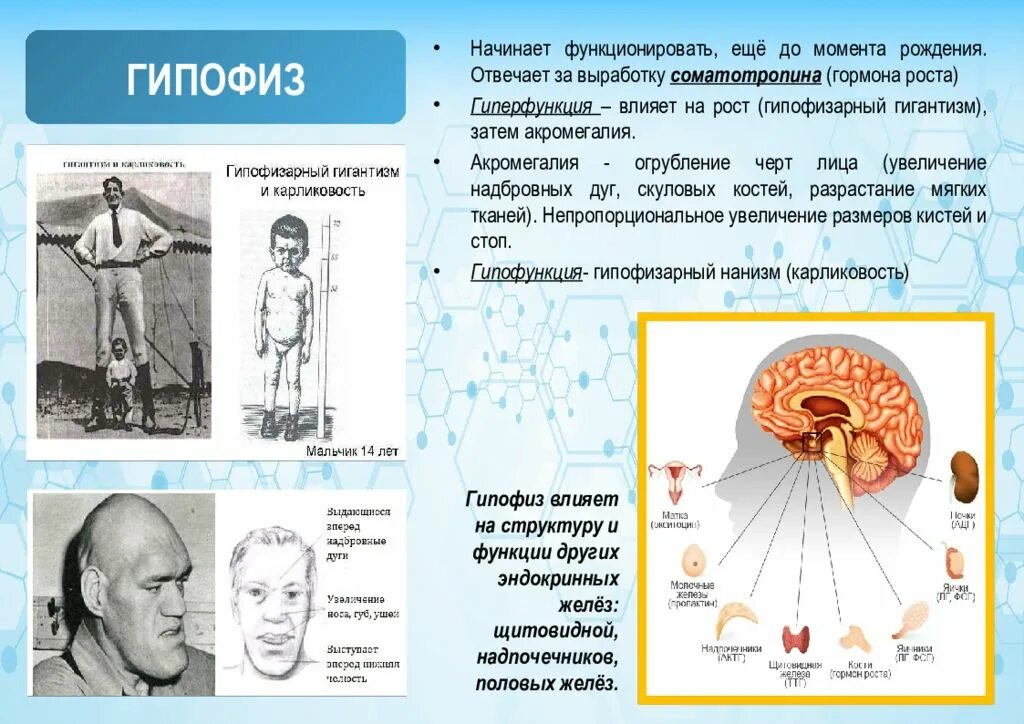 3 признака гипофиза. Гипофиза гиперфункция соматотропин. Нарушение работы желез внутренней секреции. Болезни гипофиза заболевания эндокринной системы. Эндокринная система соматотропин гипофиз.