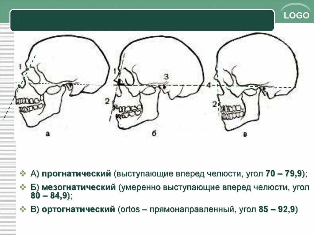 Черепная аномалия. Филогенез черепа человека. Развитие черепа в филогенезе. Стадии формирования черепа. Филогенез мозгового черепа.