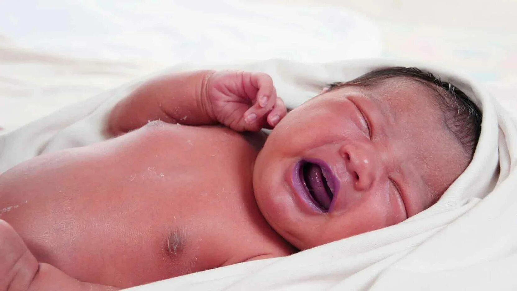 Пук новорожденных. Цианоз кожи у новорожденного. Периоральный цианоз у новорожденных. Новорожденный ребенок. Синюшность новорожденных.