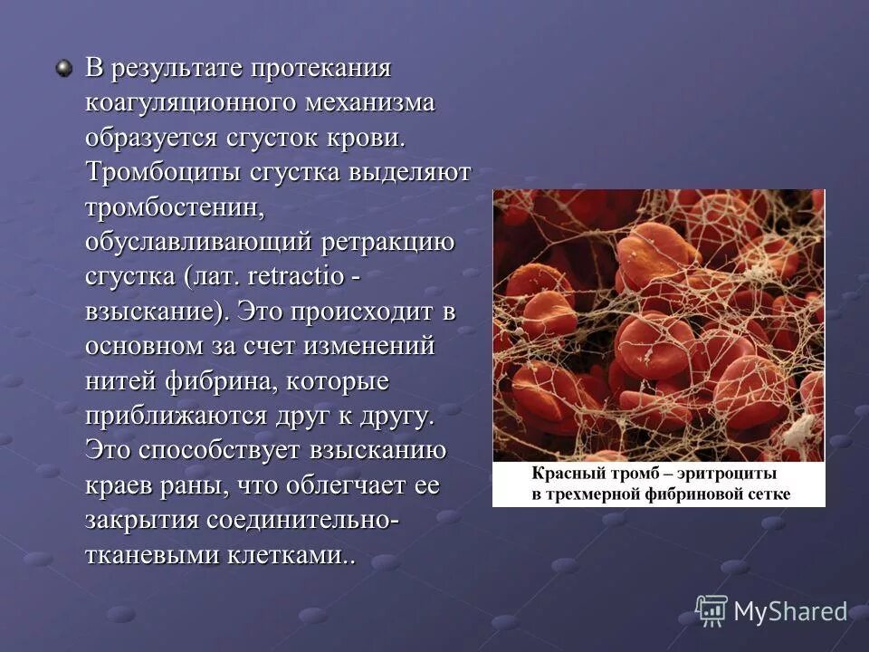 синдромы кроветворения