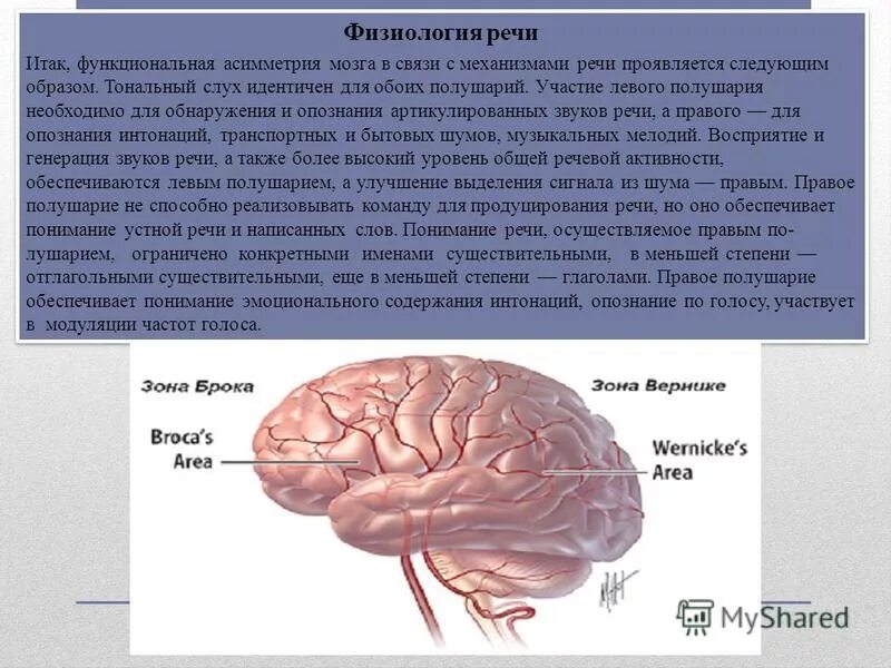 Нарушение центра речи. Речевые зоны коры головного мозга. Моторная алалия локализация поражения. Моторная афазия брока. Мозг и речь.