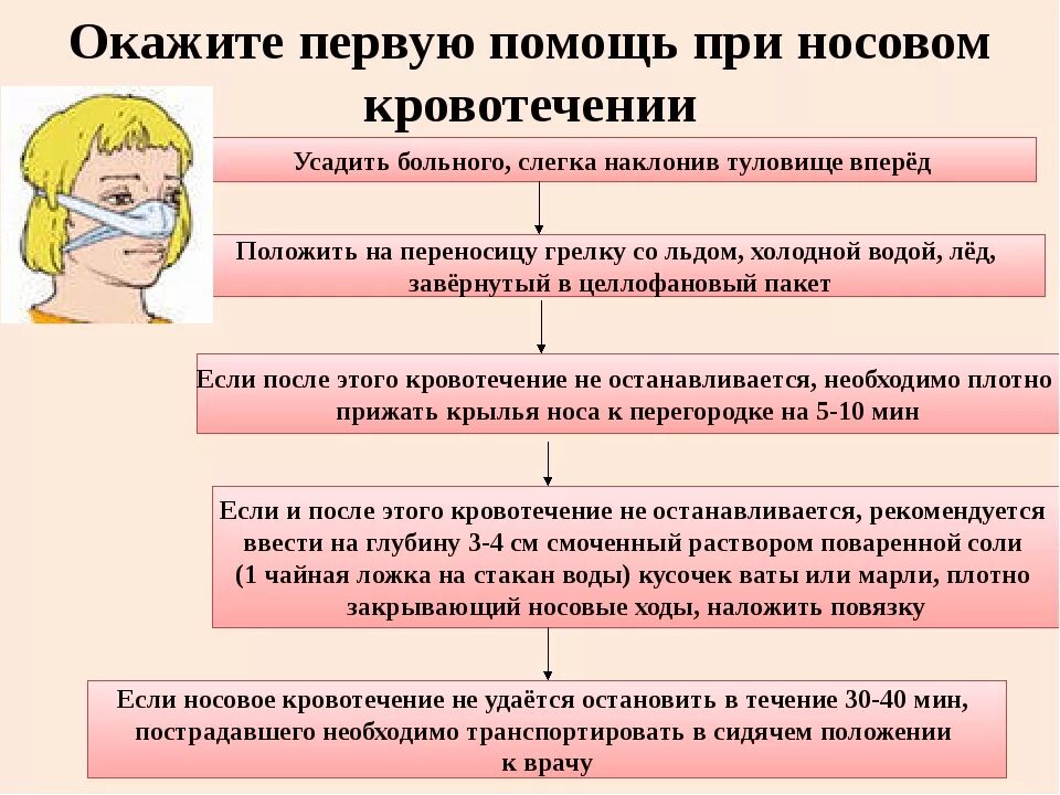 Почему у беременных кровь из носа. Алгоритм оказания ПМП при носовом кровотечении. Алгоритм ПМП при кровотечениях из носа. Алгоритм оказание ПП при носовом кровотечении. Первая помощь при носовом кровотечении у детей алгоритм действий.