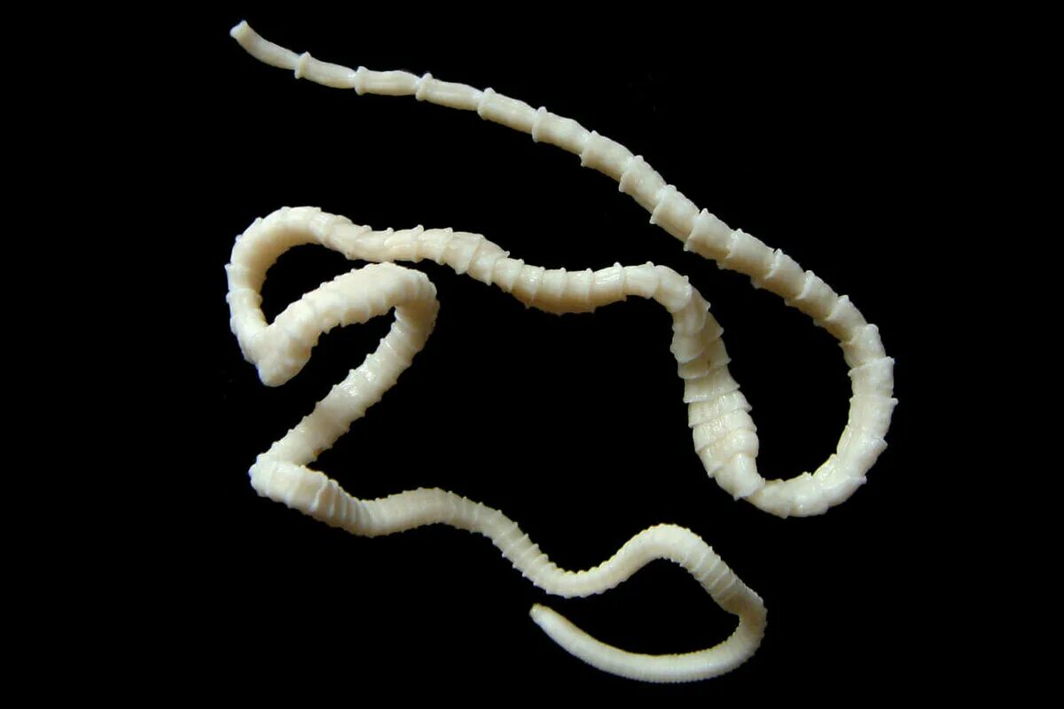 Hymenolepis nana яйца. Черви паразиты бычий цепень. Ленточные черви (цестоды) у кота. Ленточный глист солитер. Ленточный червь лентец.