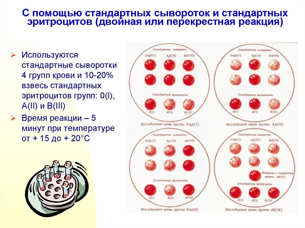 Группа крови стандартные эритроциты. Группы крови стандартными сыворотками. Определить группу крови с помощью стандартных сывороток. Определение группы крови цоликлонами схема. Таблица цоликлонов