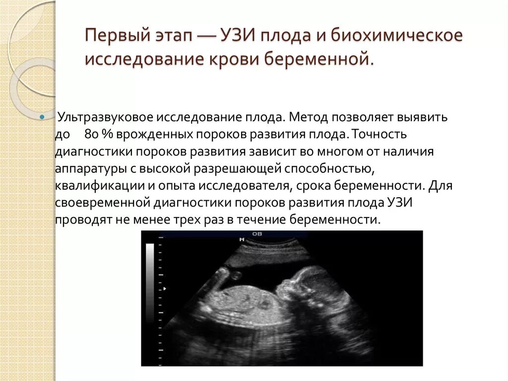 Узи аномалий. Точность УЗИ. УЗИ определение. Определение плода по УЗИ. Пороки развития плода на УЗИ.