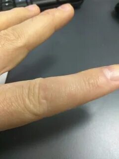 Косточки на указательном пальце руки
