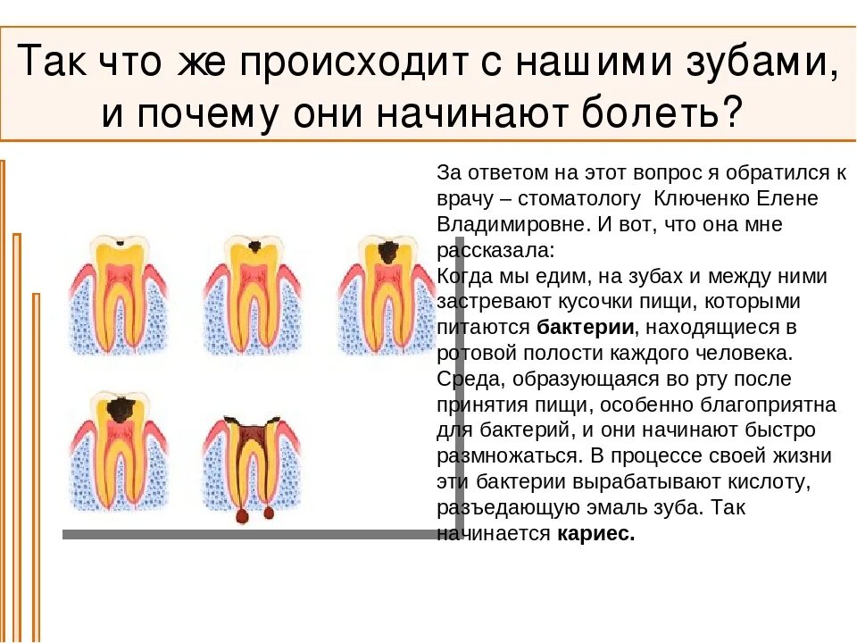 Причины почему болит зуб. Почему начинает болеть зуб. Когда начинает болеть зуб.