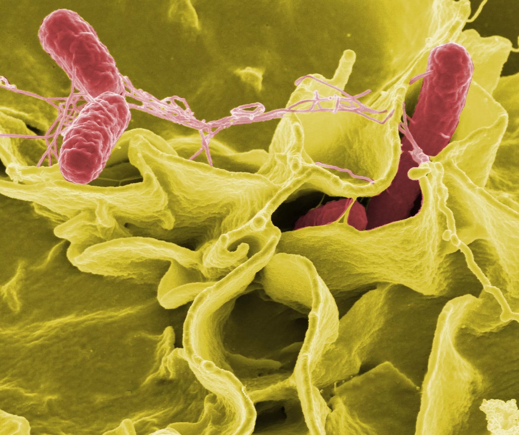 Salmonella enterica. Сальмонелла тифимуриум. Болезнетворные бактерии сальмонелла. Сальмонеллез бактерия возбудитель. Сальмонелла Тифи под микроскопом.