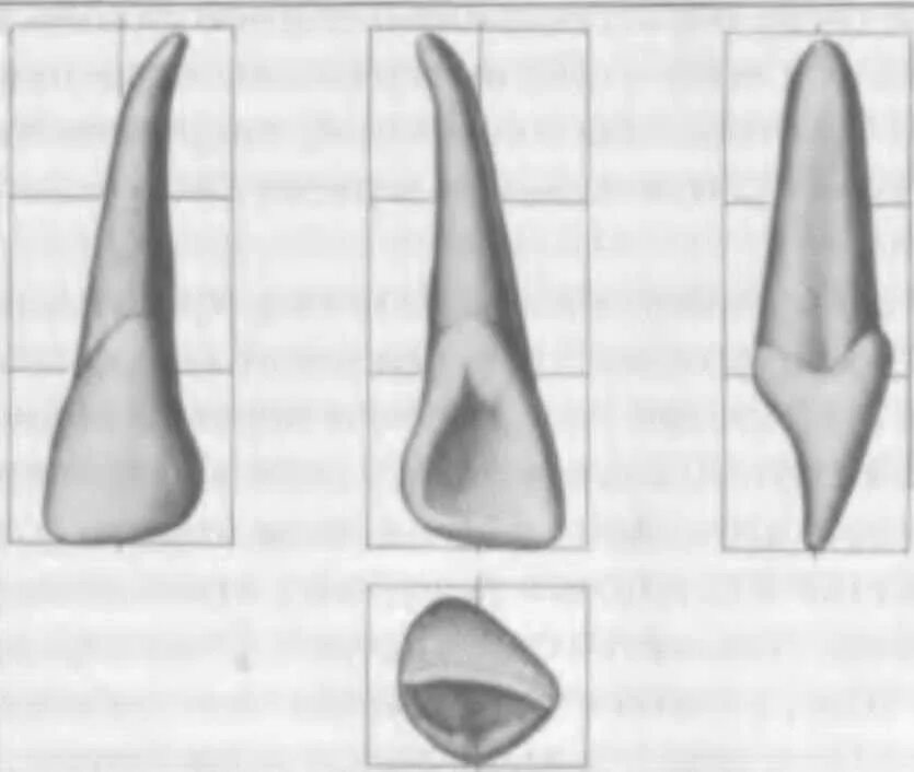 Центральный медиальный резец верхней челюсти. Верхняя челюсть анатомия мезиальный резец. Медиальный резец верхней челюсти анатомия. Латеральный резец верхней челюсти. Форма центральных резцов.