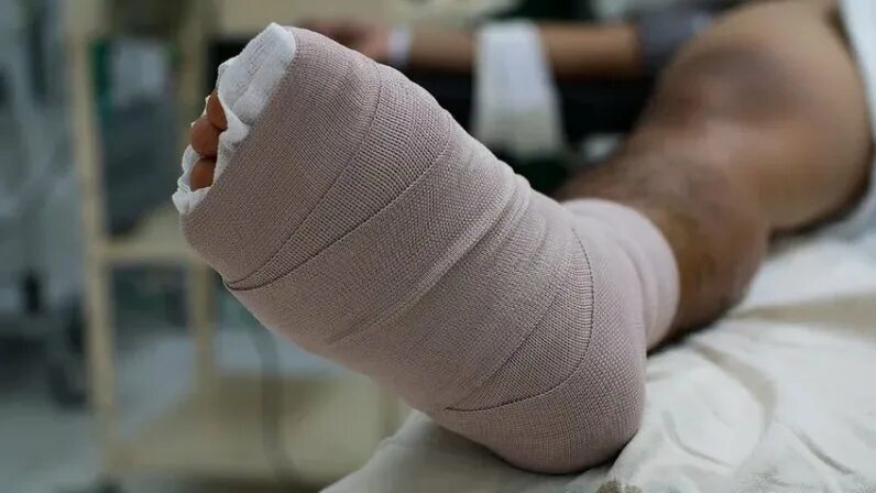 Первые признаки диабетической стопы