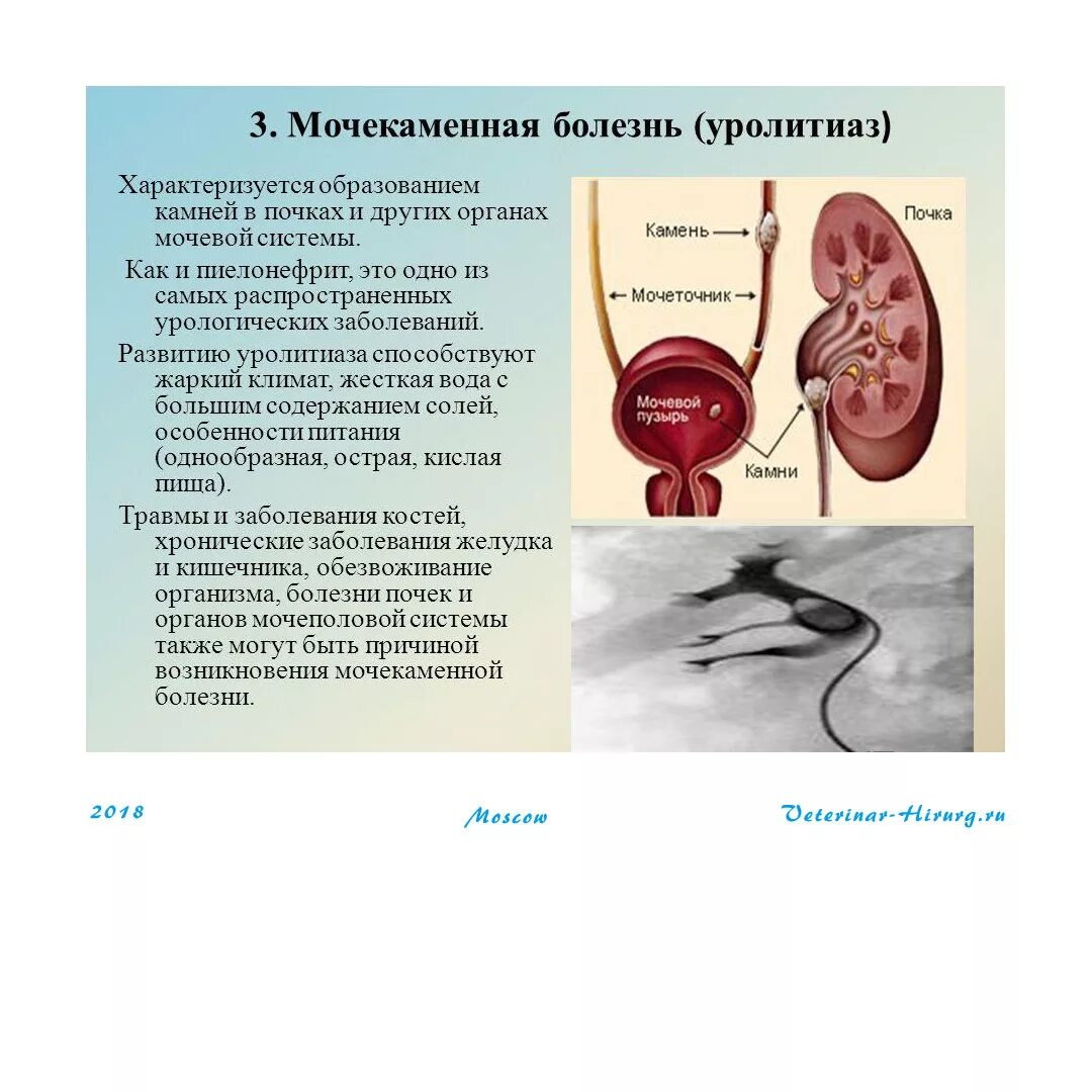 Мочевая колика. Почечнокаменная болезнь механизмы образования почечных камней. Мочекаменная болезнь урология камни мочеточника. Заболевания мочевыделительной системы мочекаменная болезнь. Мочеполовой системы - мочекаменная болезнь.