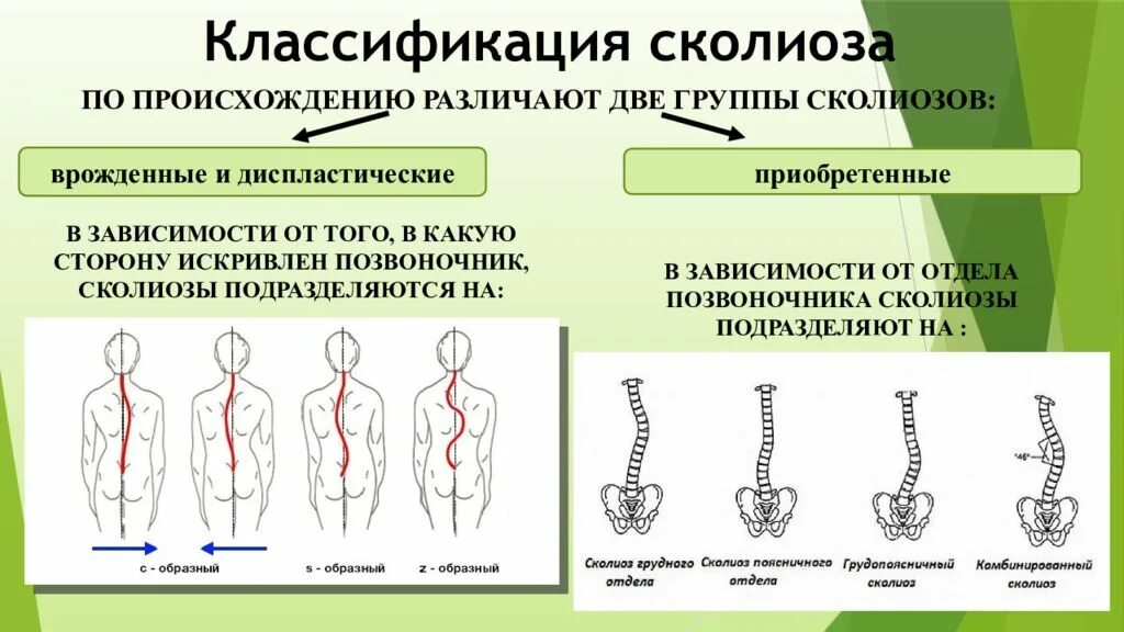 Врожденный сколиоз классификация. Классификация Кобба сколиоз. Рентгенологическая классификация сколиоза. Классификация сколиоза у детей. Группа в зависимости от происхождения