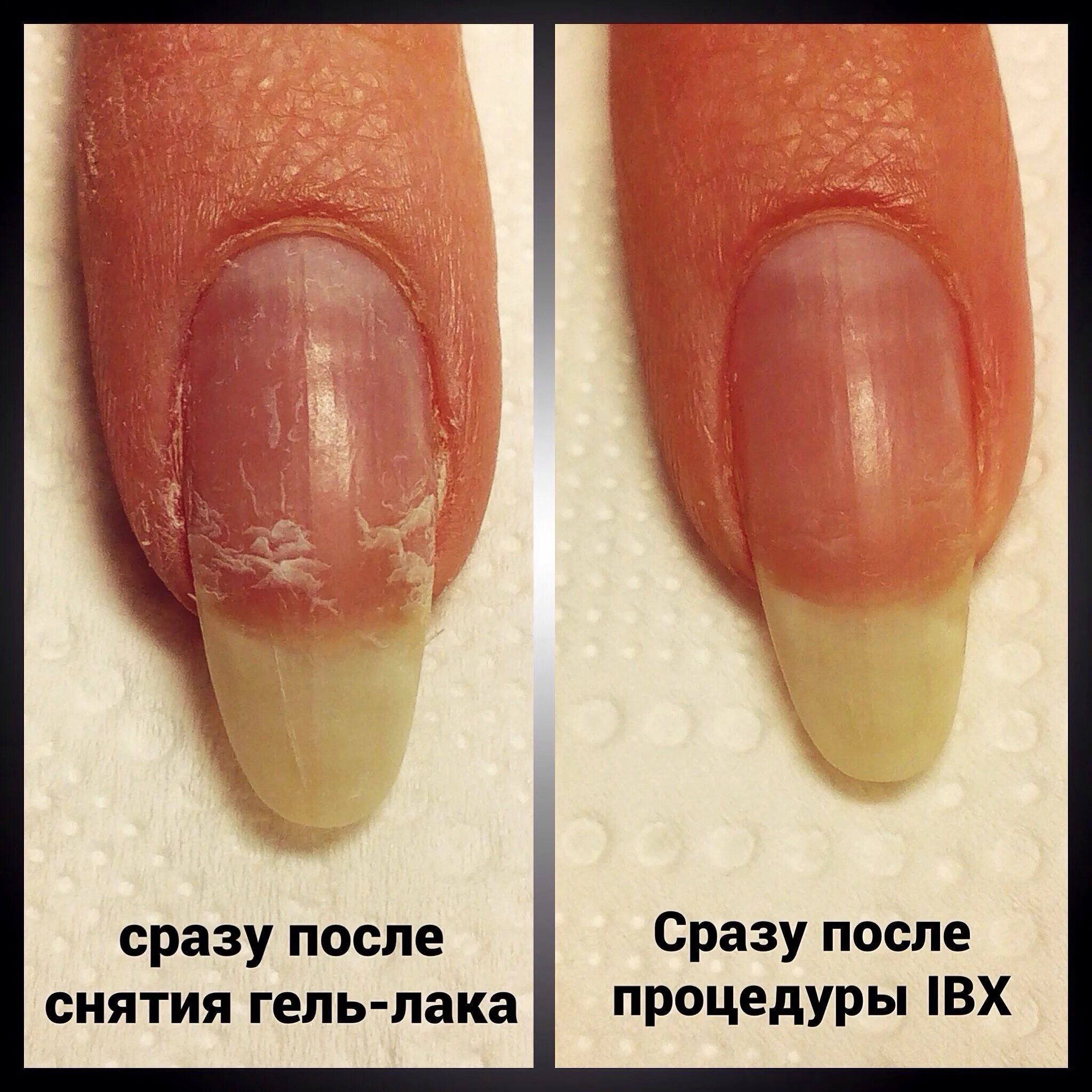Изменение формы ногтей. Выравнивание ногтевой пластины. Укрепление ногтей базой. Выравнивание ногтевой пластины гелем. Гель лак для выравнивания ногтевой пластины.