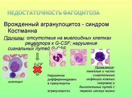 Иммунная нейтропения