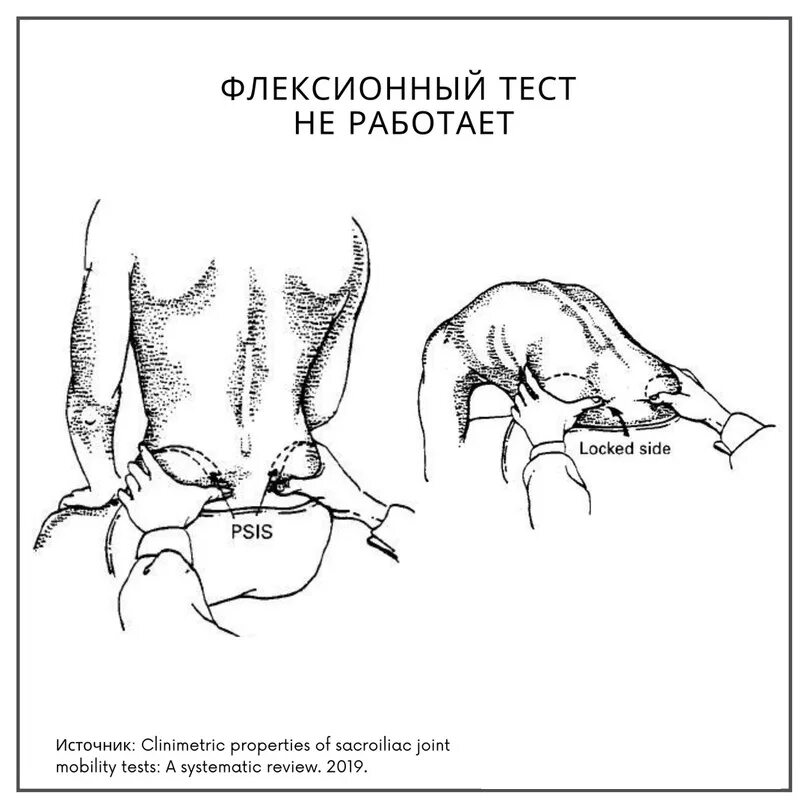 Флексионный тест. Тесты на крестцово подвздошный сустав. Тесты кречиуово подвзошнооо сустава. Флексионный тест в остеопатии. Тест 5 линий