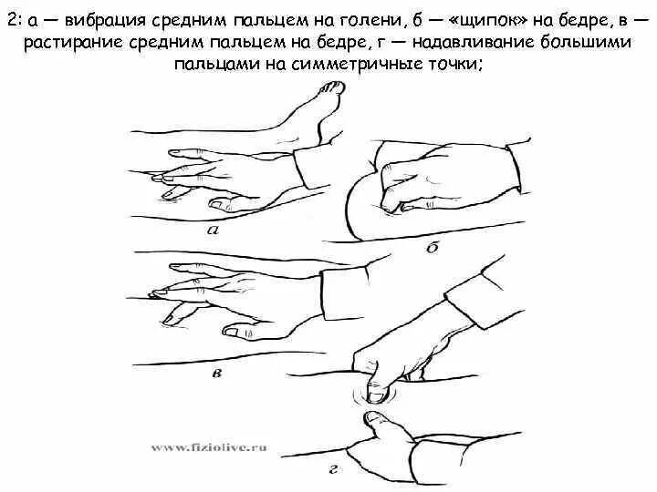 Надавливание большими пальцами. Положительный симптом жгута и щипка.