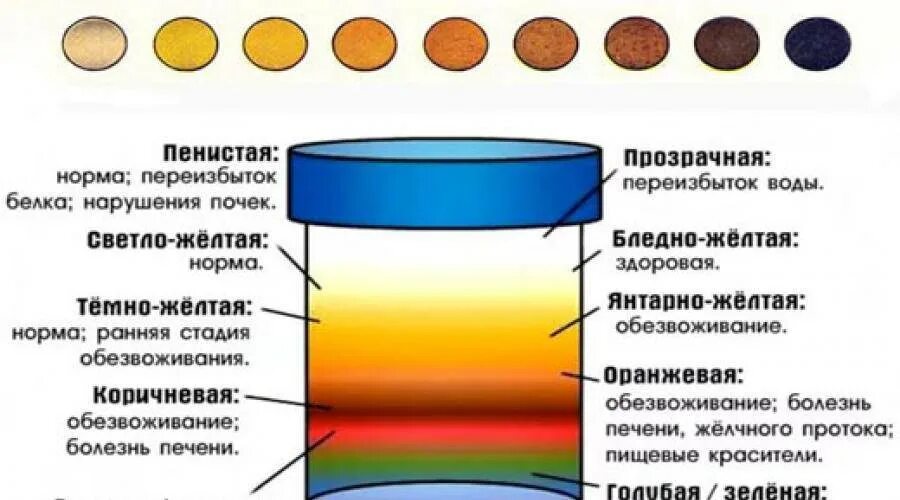 Почему яркая моча у женщин. Темный цвет мочи. моча нормального цвета. коричневый цвет мочи. темно желтая моча.