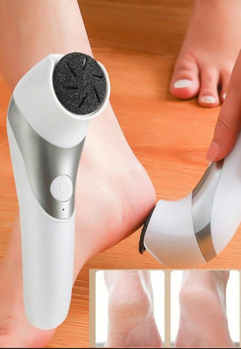 Épilateur électrique pour callosités