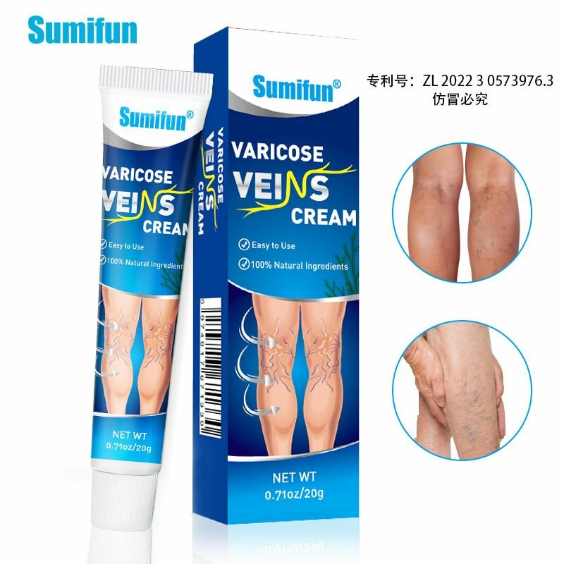 Varicose vein cream