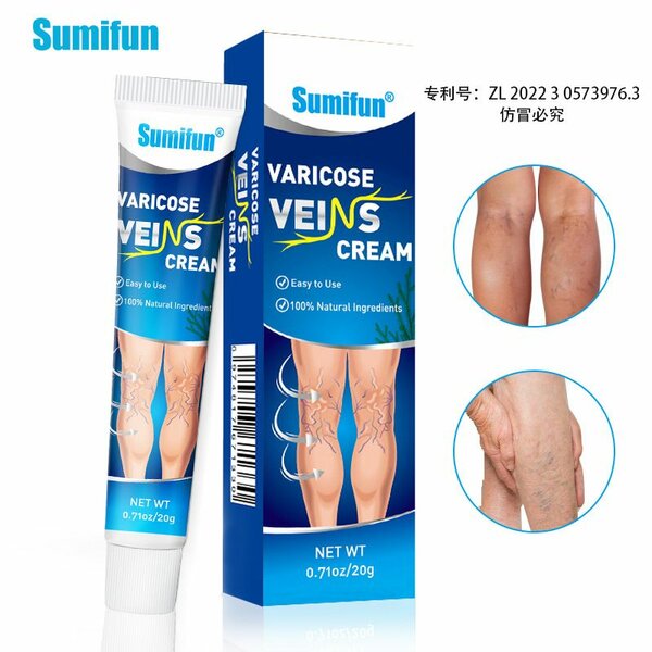 Varicose vein cream