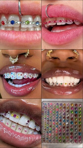 Strass dentaire