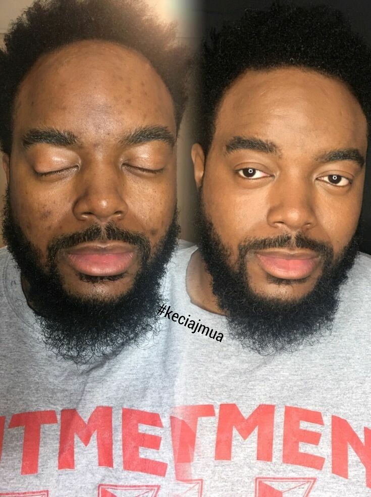 SKIN REPAIR