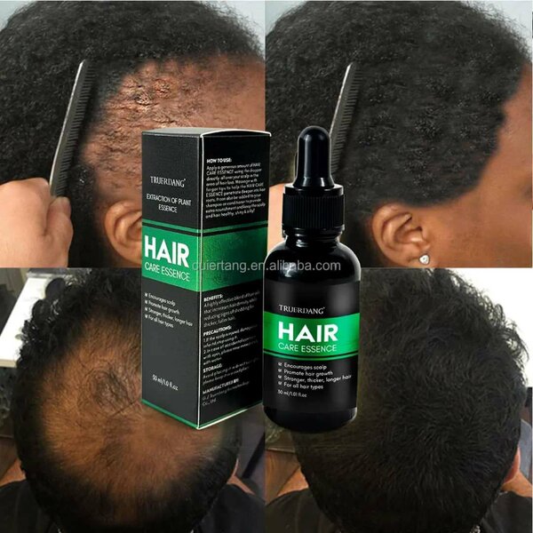 Essence de Croissance Cheveux