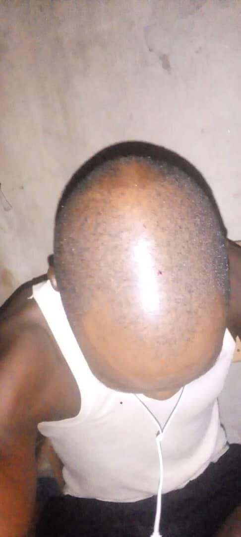 Shampoo anti-chute puissant
