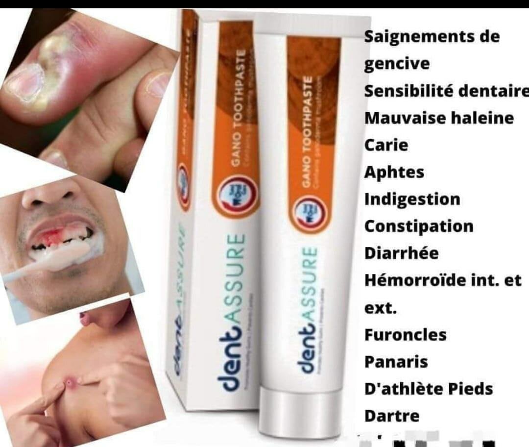 Dentassure