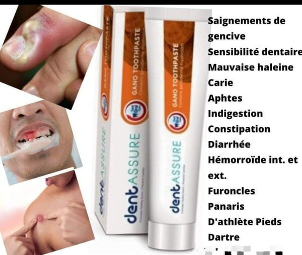 Dentassure