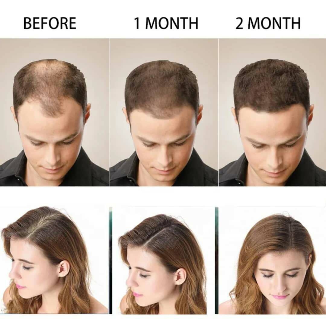 Shampooing Anti-Chute Disaar