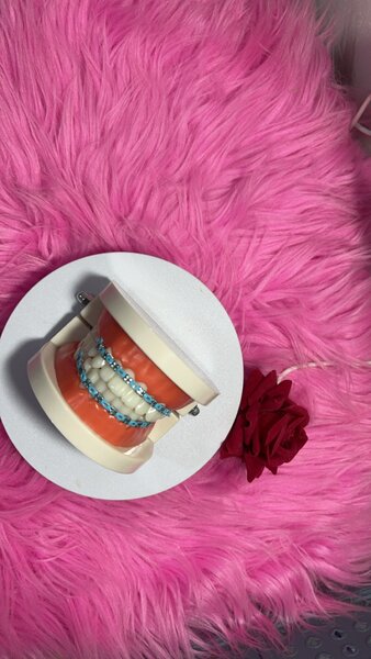 Fashion braces