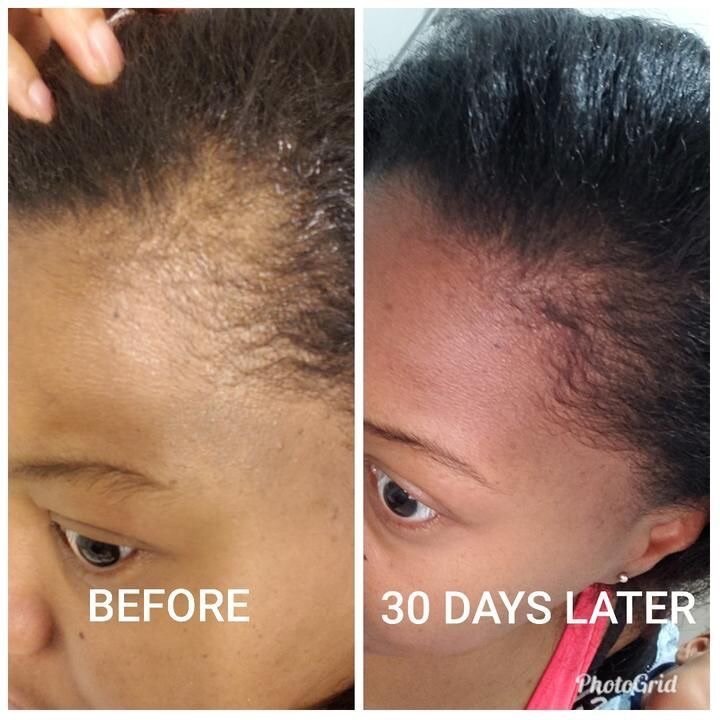 Hair Growth Oil