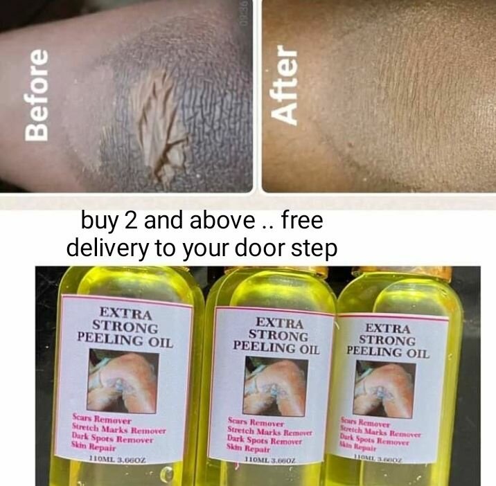 peeling oil
