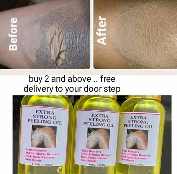peeling oil