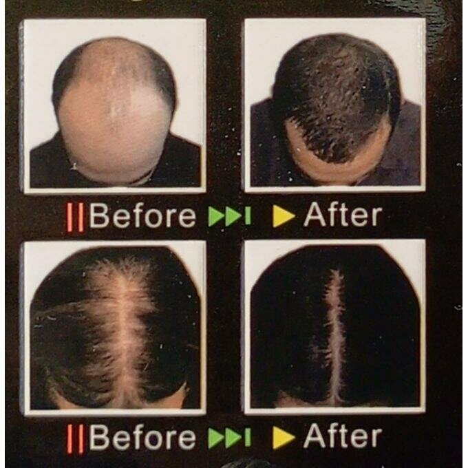 Shampoo Anti-chute Cheveux