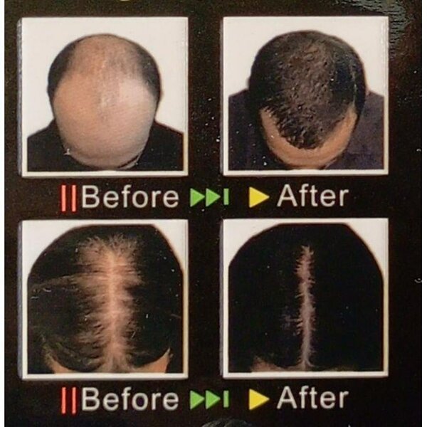 Shampoo Anti-chute Cheveux
