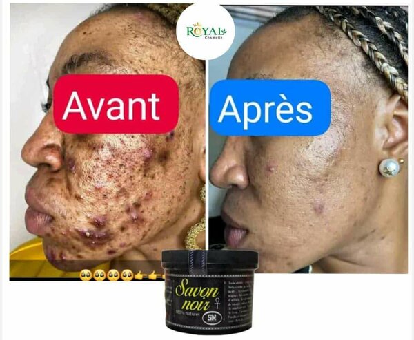 Savon noir royal
