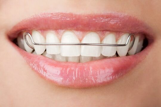 Retainers