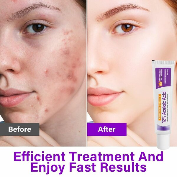 12% AZELAIC ACID