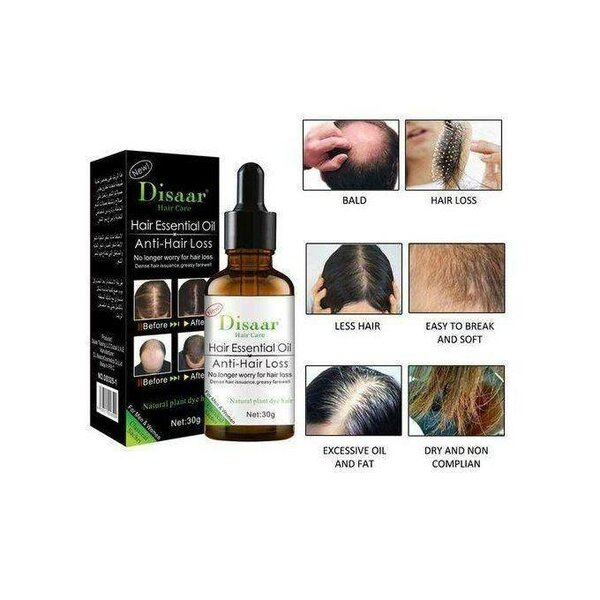 Huile Essentielle Anti-Chute Cheveux