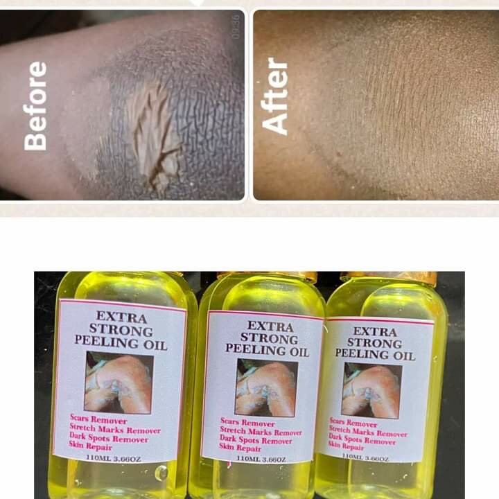 Peeling oil