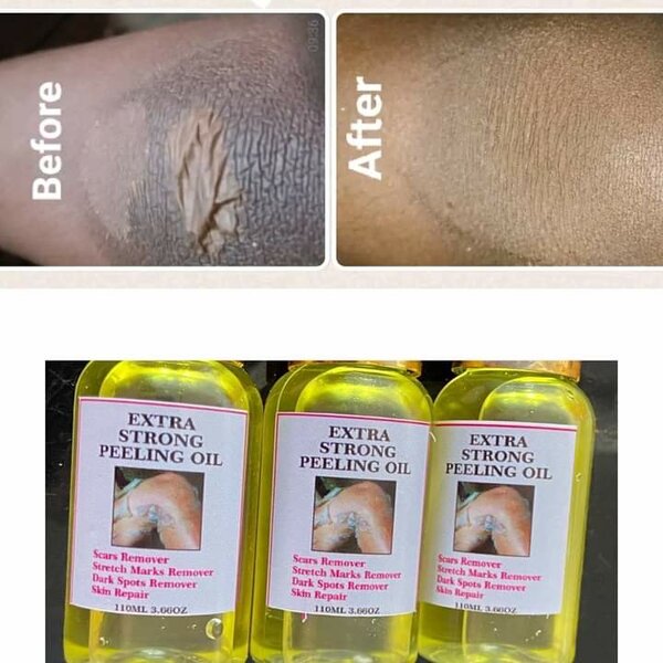 Peeling oil