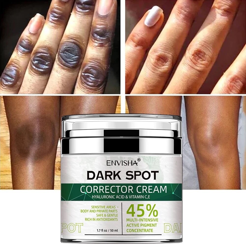 Crème pour les taches