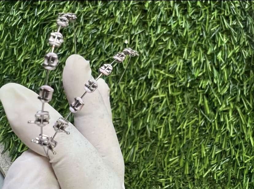 Fashion braces
