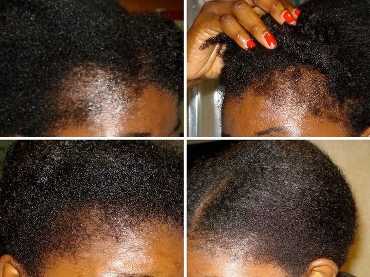 Hair booster oil 55gh, Hair cream 45gh, Derma roller 60gh