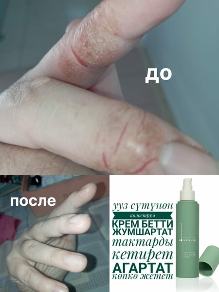 Colostrum cream