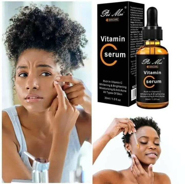 Vitamin C