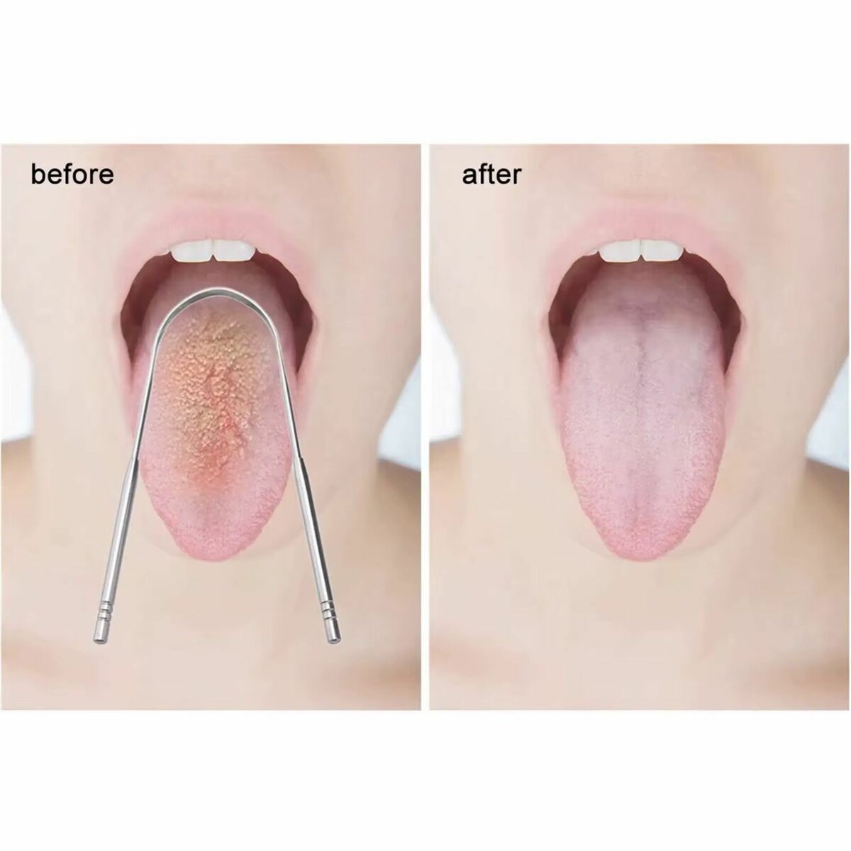Gratte-langue en acier inoxydable