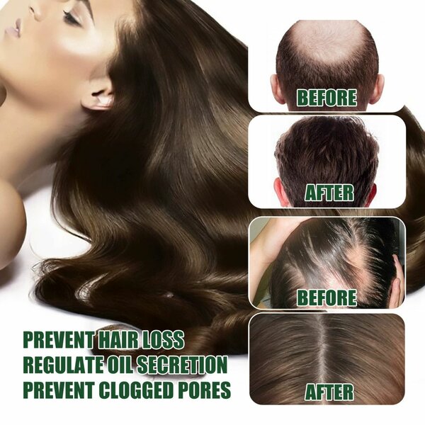 Hair growth oil